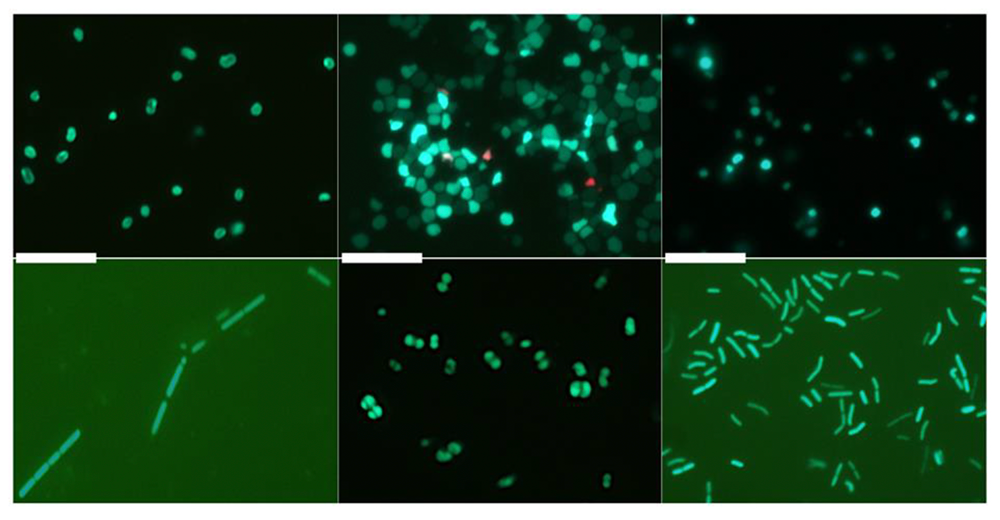 Fluorescence micrographs of variety of methanogenic microorganisms living in the marine sediments of the eastern Nankai Trough